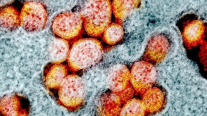 新型コロナウイルスの顕微鏡写真（NIAID=米国立アレルギー・感染症研究所）