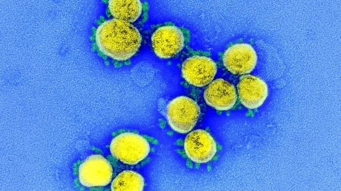 新型コロナウイルスの顕微鏡写真（NIAID=米国立アレルギー・感染症研究所）